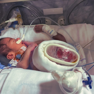 Cuidado en enfermería en el neonato quirúrgico