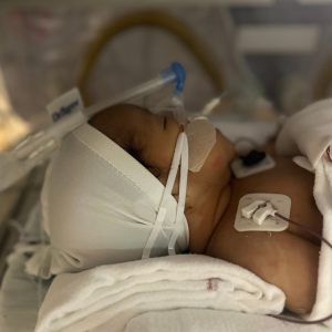 Soporte respiratorio invasivo y no invasivo neonatal-pediátrico 1